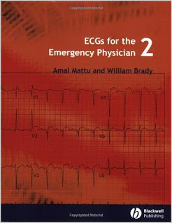 Ecg Interpretation Made Incredibly Easy 5th Edition Pdf